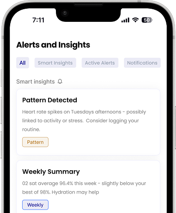 Pattern detection